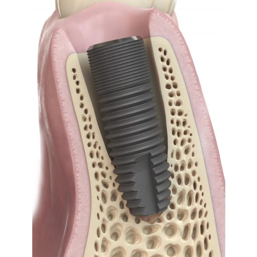 Astra Tech Implant EV OsseoSpeed 4.2 S