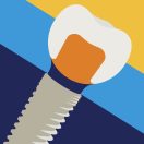 EV protetikai megoldások